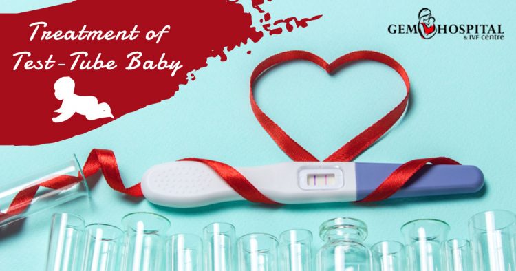 Treatment-of-test-tube-baby-1