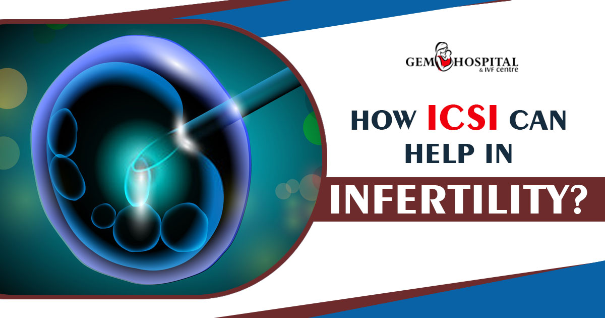 How ICSI can help in infertility