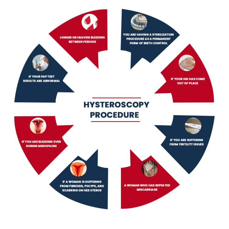 Hysteroscopy procedure