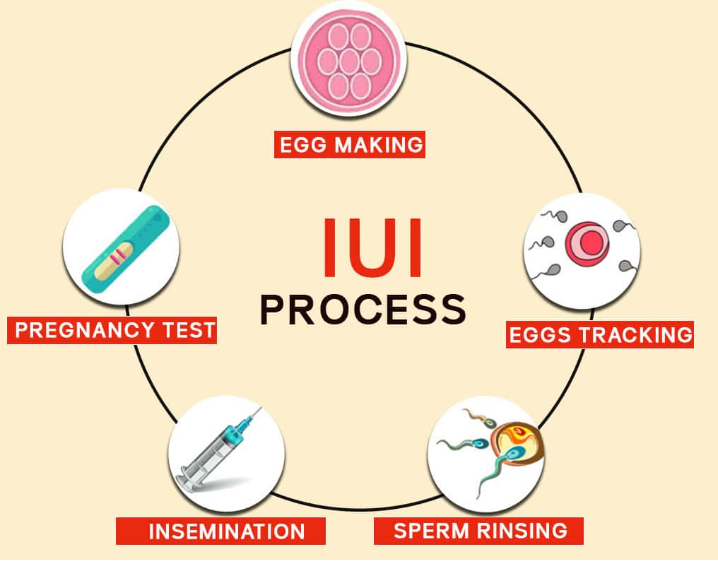 IUI process - Gem Hospital and IVF centre