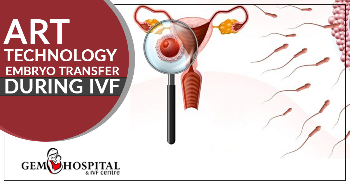 ART technology - Embryo Transfer During IVF