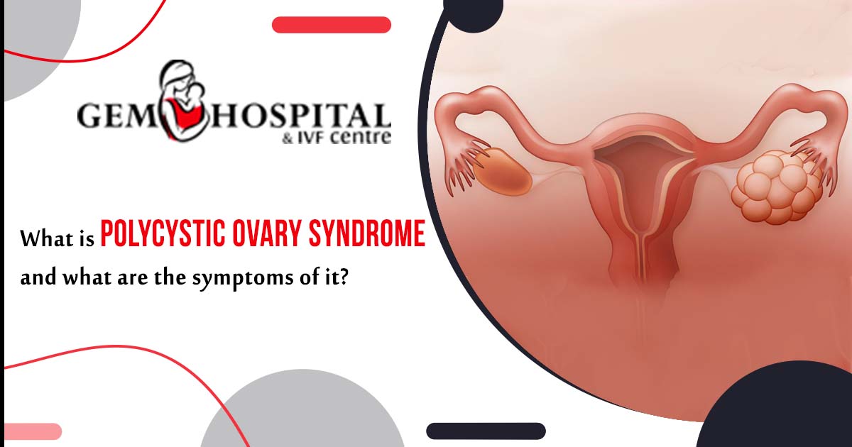 What is polycystic ovary syndrome and what are the symptoms of it