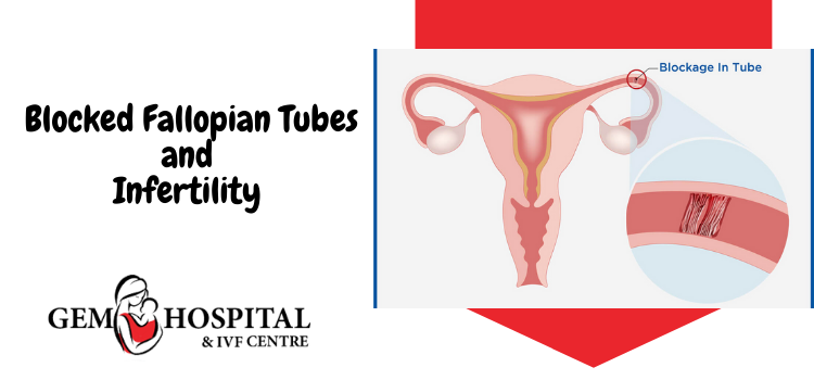 _ Blocked Fallopian Tubes and Infertility
