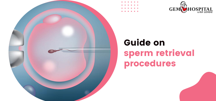Guide on sperm retrieval procedures