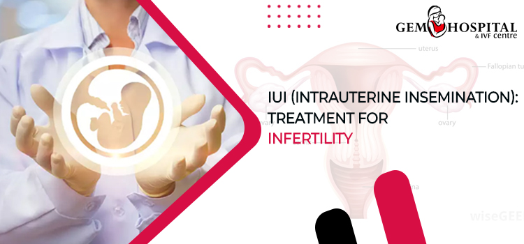 IUI (Intrauterine Insemination): Treatment For Infertility