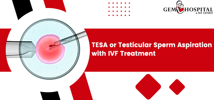 TESA or Testicular Sperm Aspiration with IVF Treatment