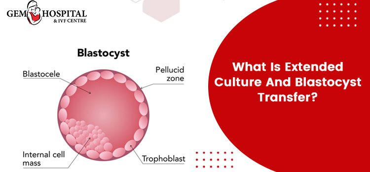 What Is Extended Culture And Blastocyst Transfer